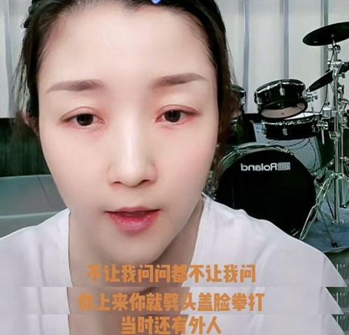 歌手网红吃瓜视频下载,揭秘娱乐圈幕后故事 第2张 歌手网红吃瓜视频下载,揭秘娱乐圈幕后故事 第2张